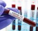 As clinical trials halt, U.S. COVID-19 cases surge